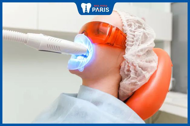 Tẩy trắng răng bằng tia laser có thể khắc phục răng nhiễm màu kháng sinh