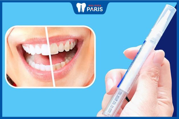 Bút tẩy trắng răng là gì? Ưu điểm nổi bật và cách dùng
