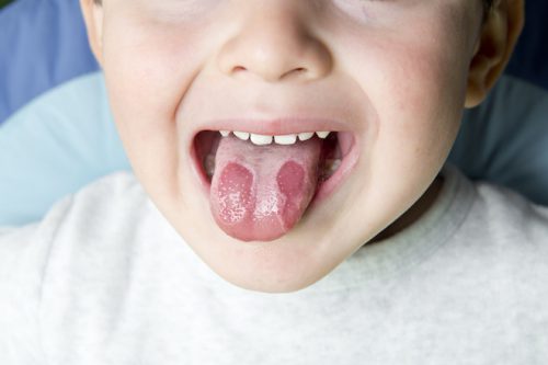 cách chữa cam miệng ở trẻ em