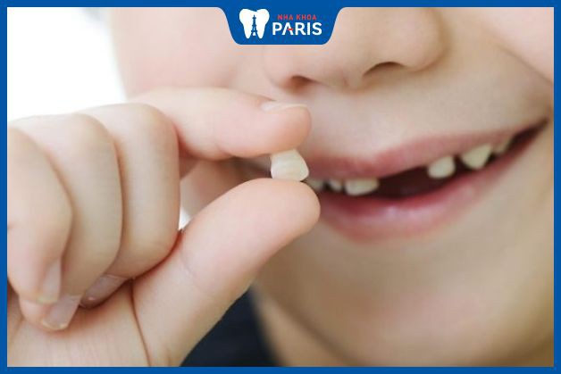Răng hàm trẻ em có thay không - Trường hợp có thay