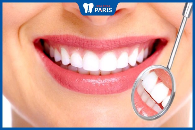 Răng Nacera Shell giúp che lấp những khuyến điểm của răng một cách hoàn hảo