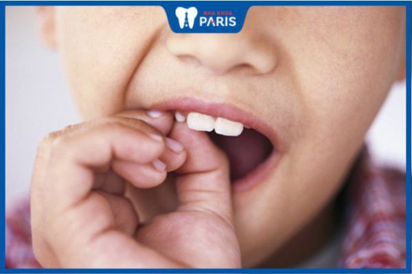Trẻ em có thay răng hàm không? Lưu ý trong quá trình thay răng