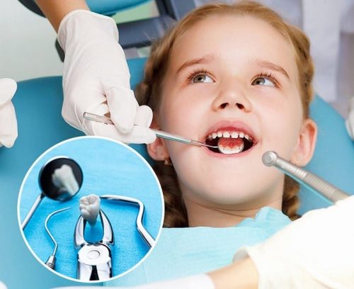 trẻ em có thay răng hàm không