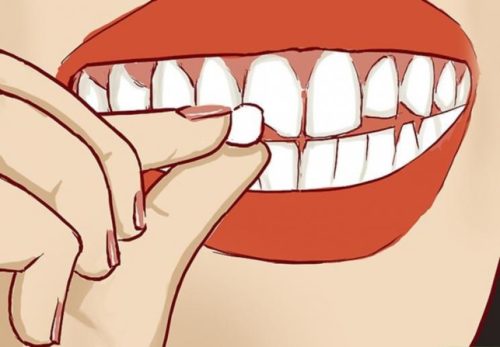 cách phục hồi răng bị mẻ tại nhà
