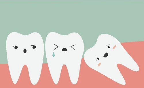 răng không sâu nhưng đau có thể do mọc răng khôn
