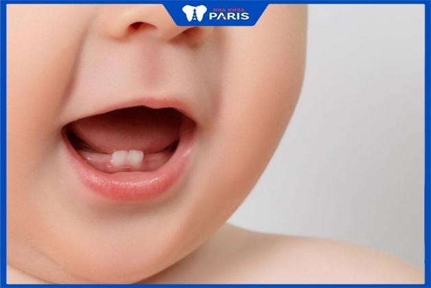 trẻ mọc răng không đúng thứ tự - Trẻ mọc răng nào đầu tiên