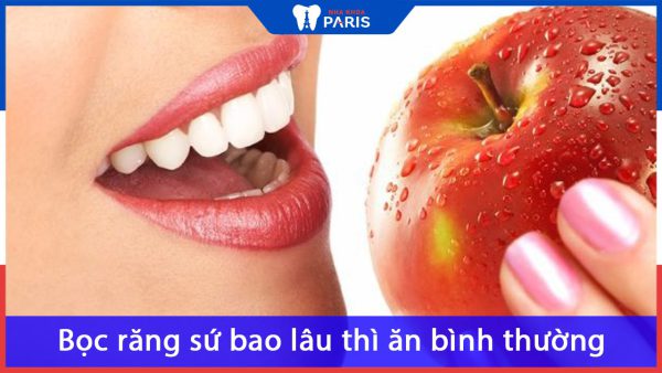 Bọc răng sứ bao lâu thì ăn uống bình thường được? Nên ăn gì?