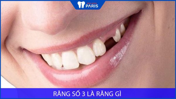 Răng số 3 là răng gì? Thay khi nào? Nhổ bỏ có nguy hiểm không?
