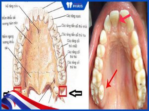 Răng số 9 là răng nào? Khi mọc có ảnh hưởng gì không?
