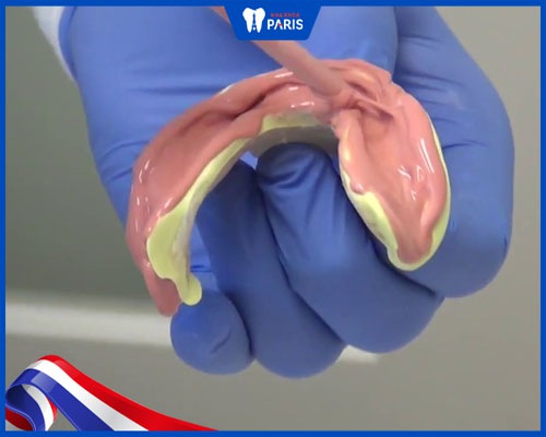 quy trình làm răng sứ zirconia