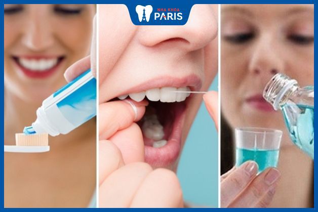 Cách vệ sinh răng miệng cũng ảnh hưởng đến tuổi thọ răng sứ