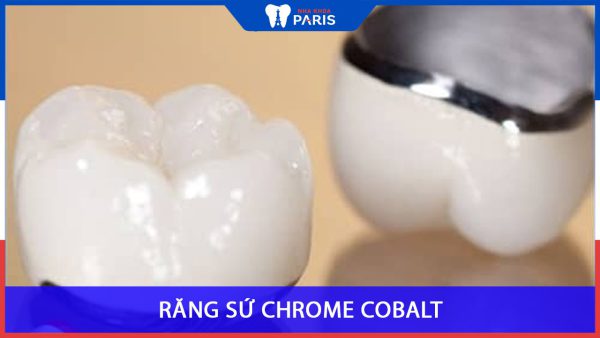 Răng sứ Chrome cobalt là gì? Có tốt không? Làm ở đâu?