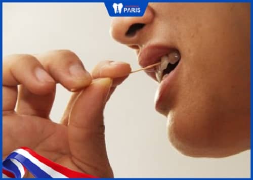 xỉa răng khắc phục giắt răng