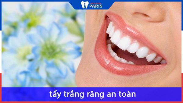 Top 3 kinh nghiệm tẩy trắng răng an toàn và hiệu quả nhất