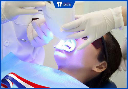phương pháp tẩy trắng răng tại nha khoa