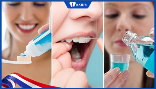 chăm sóc răng miệng tránh làm răng sứ bị đen viền