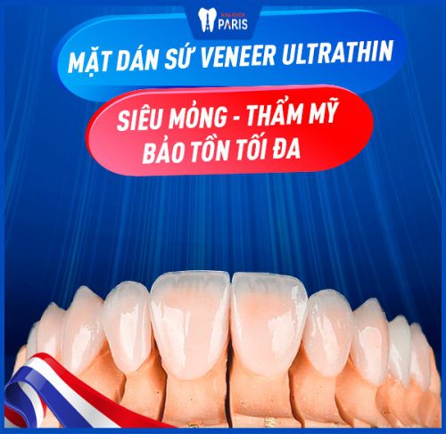 dán răng sứ có hại không
