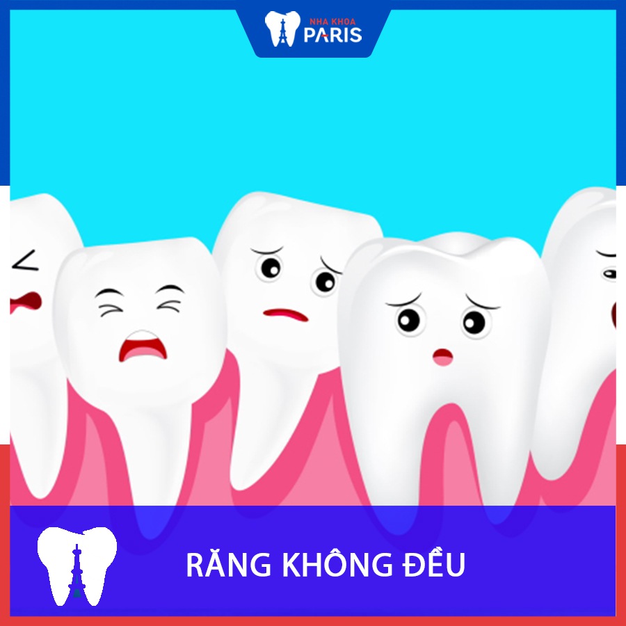 Nguyên nhân răng không đều? Cách khắc phục tại nhà