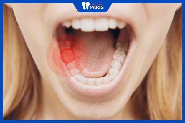 Bệnh lý răng miệng là nguyên nhân gây rụng răng