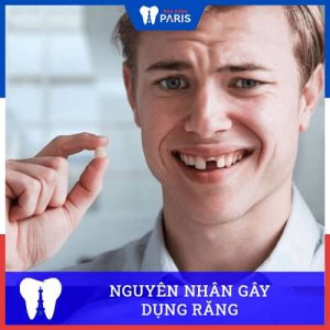 Rụng răng do nguyên nhân gì – Những tác hại khi rụng răng