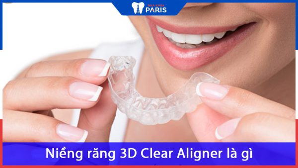 Niềng răng 3D Clear Aligner là gì? Giá bao nhiêu? Khác gì Invisalign?