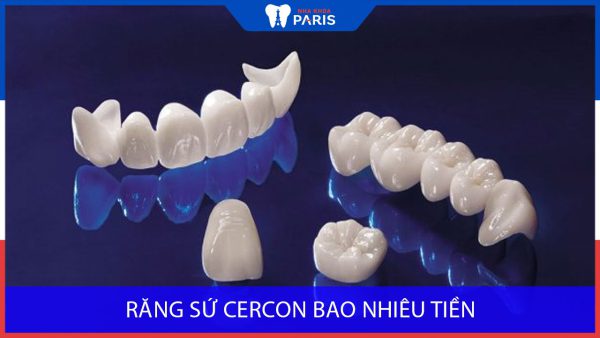 Răng sứ Cercon giá bao nhiêu? Yếu tố ảnh hưởng đến chi phí