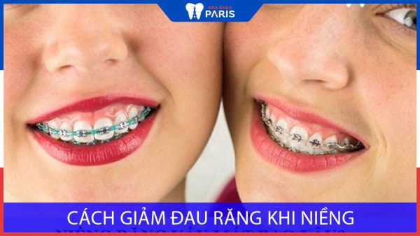 6 Cách giảm đau răng khi niềng Đơn Giản & Hiệu Quả Nhất