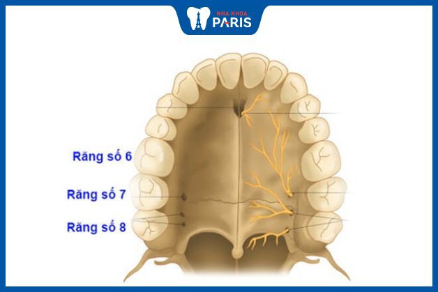 Với vị trí và chức năng quan trọng, răng 6 nên được phục hình bằng implant