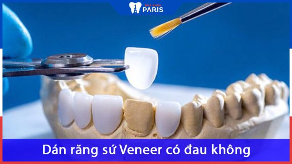 Dán răng sứ Veneer có đau không? Review thực tế