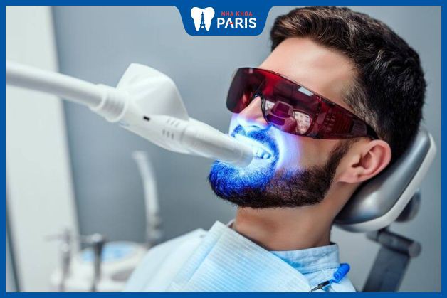 Tại sao tẩy trắng răng Laser Whitening được ưa chuộng
