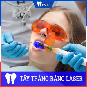 Tẩy trắng răng Laser Whitening: Ưu điểm, quy trình và chi phí
