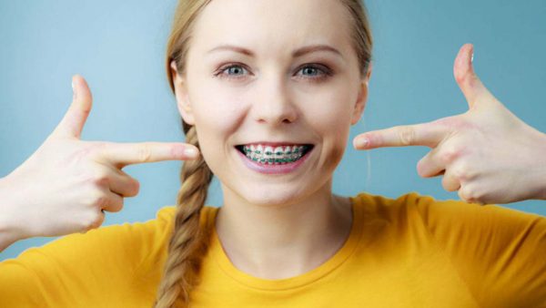 Niềng răng gây hóp má nguyên nhân do dâu? Cách khắc phục