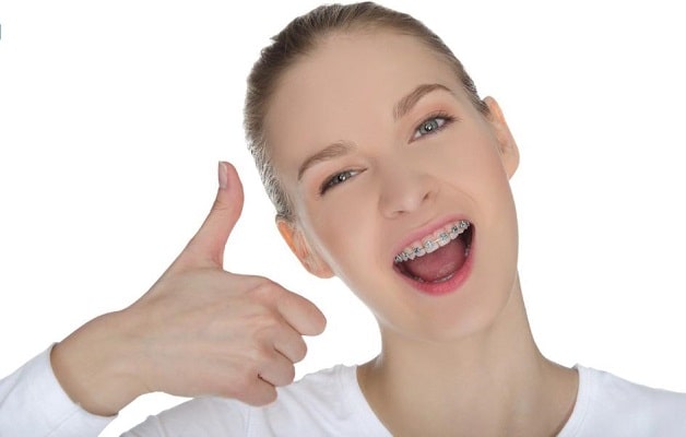 Niềng răng xong chú ý nhai chậm tránh làm ảnh hưởng chân răng