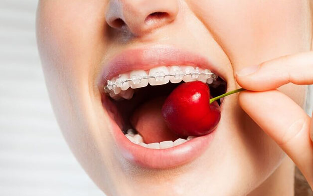 động tác ăn nhai ảnh hưởng như nào khi niềng răng