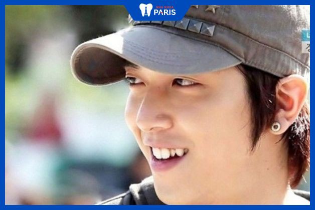 Răng khểnh cũng khiến không ít các ngôi sao Hàn Quốc chiếm được cảm tình của người hâm mộ.