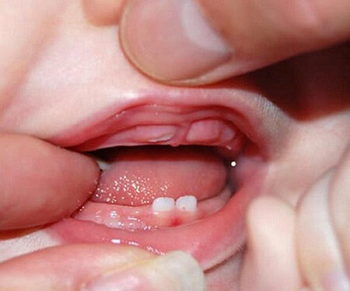 bé mọc răng hàm trong bao lâu