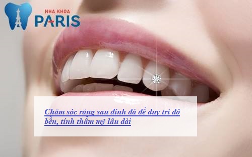 Chăm sóc răng sau đính đá là cách duy trì tính thẩm mỹ và độ bền của răng