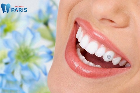 Đính đá vào răng giúp bạn sở hữu nụ cười tỏa sáng cũng như phong cách cá nhân nổi bật