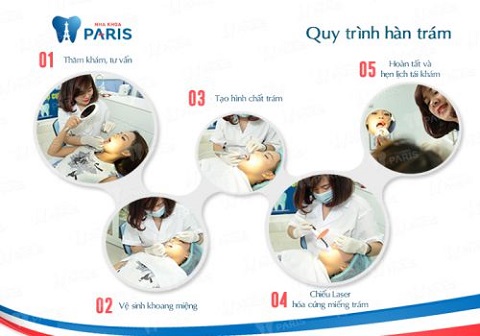 Quy trình trám răng tại Nha khoa Paris