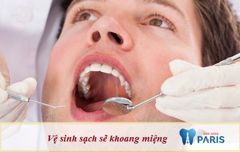 Vệ sinh sạch sẽ khoang miệng trước khi tiến hành trám răng