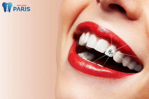 Đính đá vào răng có đắt không phụ thuộc vào tình trạng sức khỏe răng miệng của khách hàng