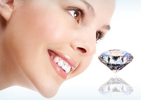 Đính kim cương lên răng bao nhiêu tiền?
