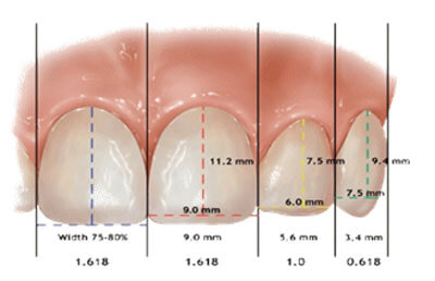 Từng chiếc răng đáp ứng về tỉ lệ quy định của một hàm răng đẹp chuẩn
