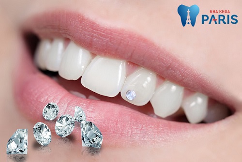 Đính một viên đá lên răng để hàm răng đẹp thêm phần nổi bật