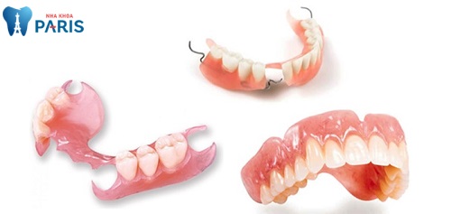 khắc phục răng không mọc được anodontia bằng hàm giả