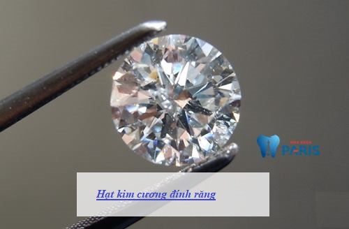 Hạt kim cương đính răng nên mua và thực hiện tại cơ sở nha khoa uy tín