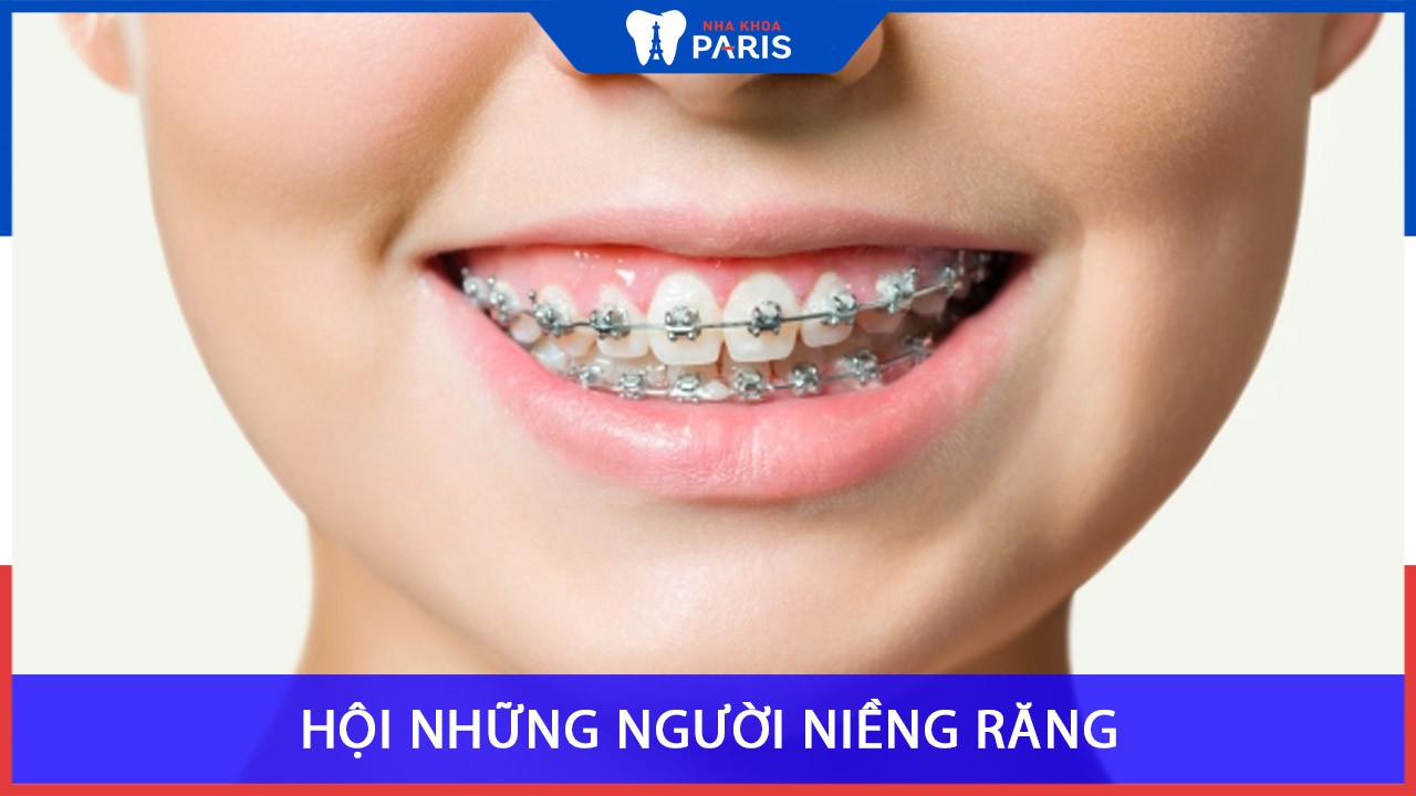 Hội người niềng răng facebook, răng Invisalign, webtretho