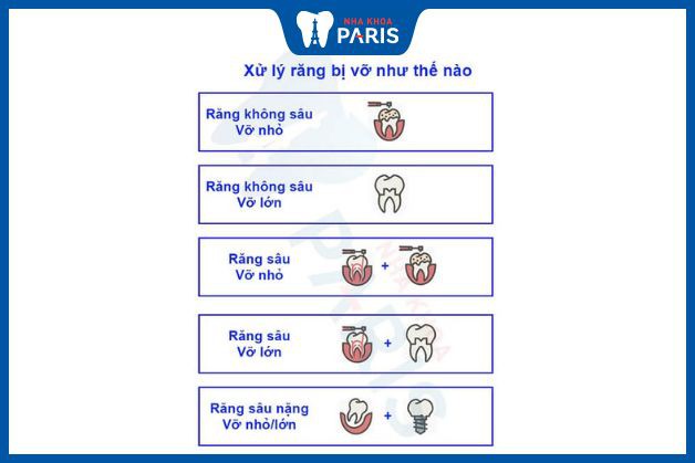 Cách xử lý răng hàm bị vỡ