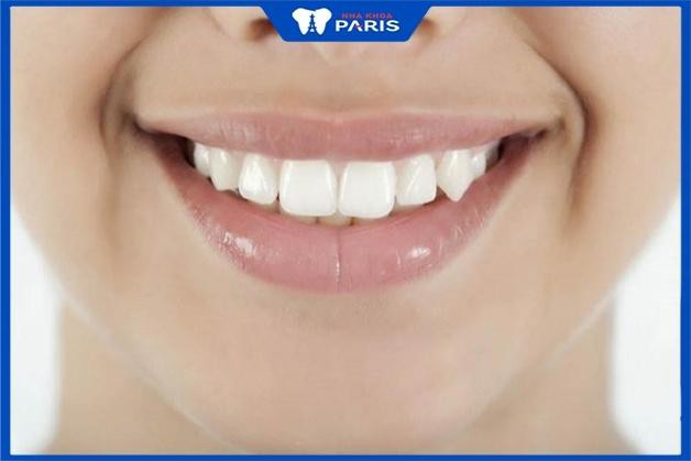 Răng nanh : Đặc điểm và chức năng của răng nanh mà bạn cần biết