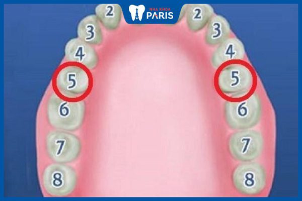 Răng số 5 là răng nào? Hậu quả khi mất răng số 5 lâu ngày